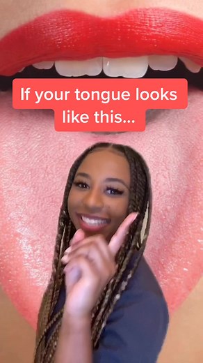 Identifying Types of Tongue Conditions and Health Indicators