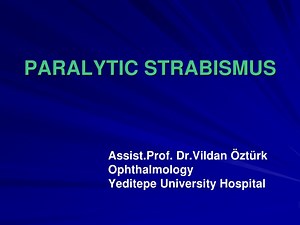 PPT - PARALYTIC STRABISMUS PowerPoint Presentation, free download - ID:3736869