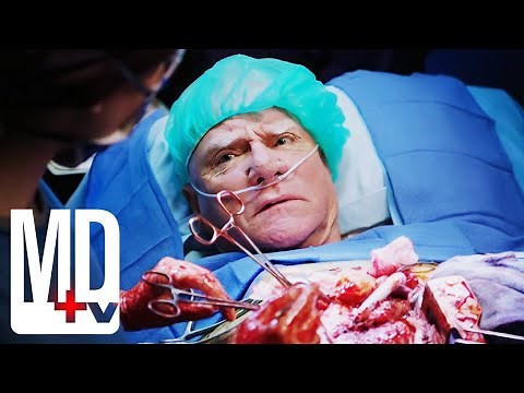 Eminent Doctor Requests Conscious Heart Surgery (Guest Star Malcolm McDowell) | Chicago Med | MD TV