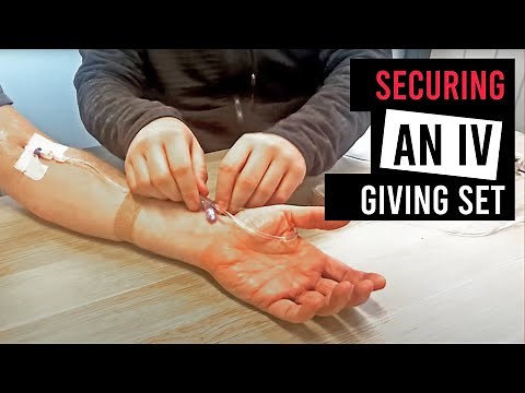 Securing an Intravenous (IV) Giving Set