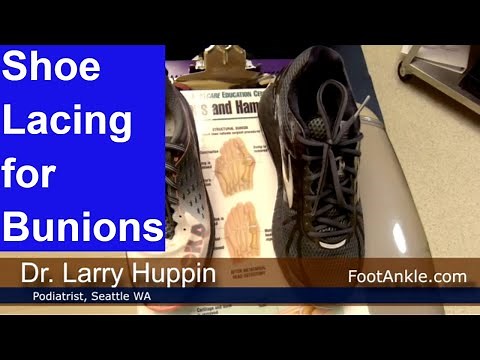 Lacing Techniques for Bunions | Seattle Podiatrist