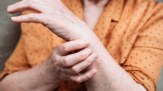 What you need to know about arthritis, from causes and management to emerging treatment
