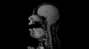 Incredible MRI Images Show What An Opera Singer Looks Like On The Inside While Singing
