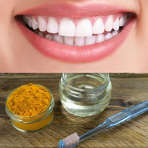 How to Heal Cavities and Tooth Decay Naturally Join: Simple Beauty Secrets | Simple Beauty Secrets