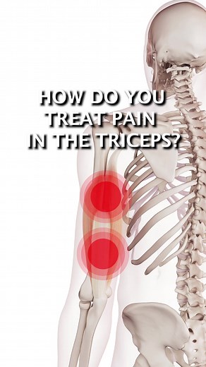 How Do You Treat Pain In The Triceps? 👉 Dry needling can help to reduce pain and stiffness in the triceps muscle, making it easier to move and perform everyday activities. 👉 Trigger points in the triceps muscle can also cause localized pain, stiffness, and reduced range of motion in the affected muscle. 👉 The radial and medial nerves may also be involved in cases of triceps pain, which can have additional effects on arm and hand function. Trigger points in the triceps muscle can cause a varie