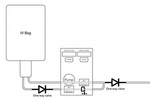 Automated IV Pump Occlusion Alleviation