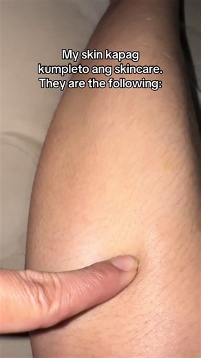 Complete Care, Complete Glow My skin kapag kumpleto ang skincare. Murag effortless glow nga padayon sa confidence 💕 Real talk, dili lalim ang skincare journey, pero worth it jud ang effort. 🌸 When I stay consistent, my skin feels smoother, healthier, ug mas confident. Hindi lang siya about vanity, kundi about self-care and discipline. Daghang salamat sa tanan nga nag-follow ug nag-like. Sharing these little wins makes me braver to show both the struggles and the glow. 💕 Padayon ta sa pag-lear