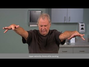 Recognizing HD Chorea: Upper and Lower Extremity Chorea