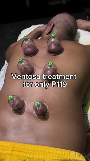 Home Ventosa Treatment for Relaxation and Relief