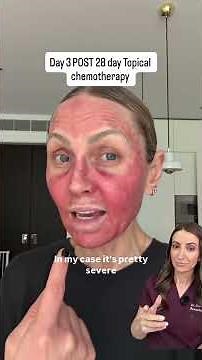 The Truth About Topical Chemo Cream