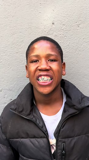 Braces progress in only 6 months! 🦷🦷🦷🦷🦷🦷🦷🦷🦷 #houseofsmilez #dentalclinic #bracestransformation #bracesbeforeandafter #fyp