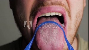 using a tongue cleaner