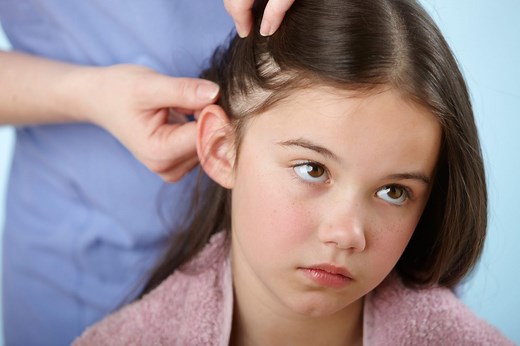 Lice? Derms Recommend These 9 Treatments That Work Fast