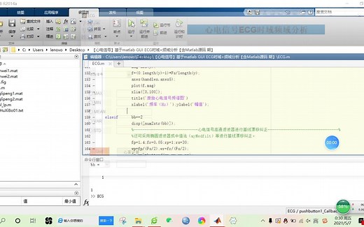 【心电信号】基于matlab GUI ECG时域+频域分析【含Matlab源码 期】