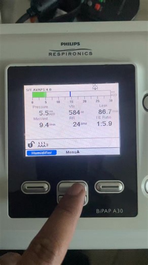 How to set Mode,Ipap,Epap, RR. #Philips #nasaloralmask #nasaloralmask #resmedvpap #a30bipap #mirdevice #a40bipap #vpapivst #SleepApneaCare #Lumis150 #Philips #resmed #ventmed #Bmc #yuwell | Bipap doctor