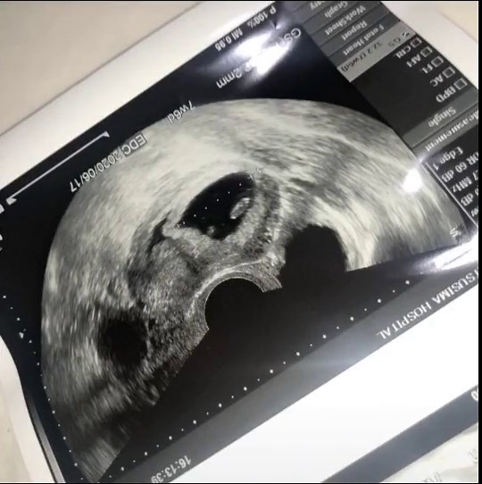 18週の妊婦の胎動体験❤️ | マタニティ日記