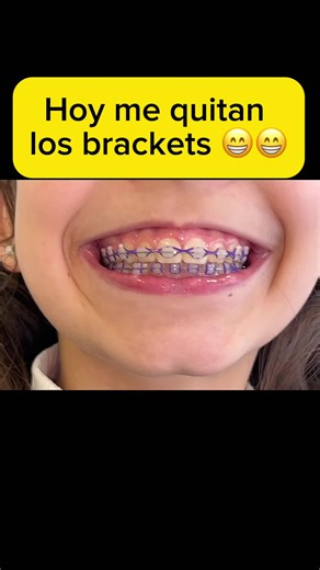 Retiro de brackets en Uruguay: Proceso y costos