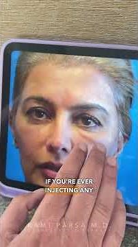 Why Did I Get Malar Edema After Fillers? Dr. Parsa Explains