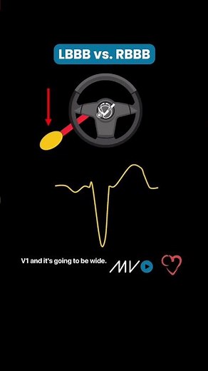 LBBB vs. RBBB Made Easy! 🫀