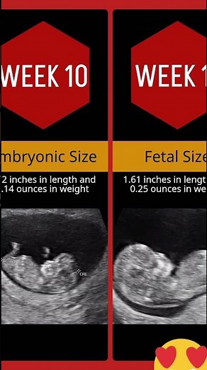 Pregnancy Week By Week || 1 - 20 Weeks Fetal Developments || Ultrasound