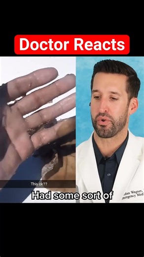 Doctor Reacts to Random Skin Shedding 🧐 | Doctor ER