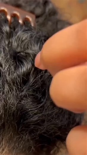 ‎یاسمین مظاهری | تریکولوژیست در حوزه مو🎖️‎ on Instagram‎: "🔻موهای پرپشت در ۴۰ روز😀 موهات داره میریزه؟ در ۴۰ روز تفاوت رو حس کن! 💁‍♀️ برای ریختن مو: قرص بیوتین پلاس برای رویش و پر شدن کف سر: کپسول سیستین B6 برای ضخیم شدن ساقه: هیرفولیک برای شوره و خشکی: امگا‑۳ گیاهی🫠 می‌خوای همه اینا رو با هم داشته باشی؟ پیـ.ـجم رو فـ.ـالو کن و زیر این پـ.ـست عدد " ۷ " رو کـ.ـامنت کن تا روندت ات شروع بشه✨ @gisoo_media @gisoo_media @gisoo_media #ریزش_مو #رویش_مو #مراقبت_مو #بیوتین #سیستین #هیرفولیک #موی_پرپشت