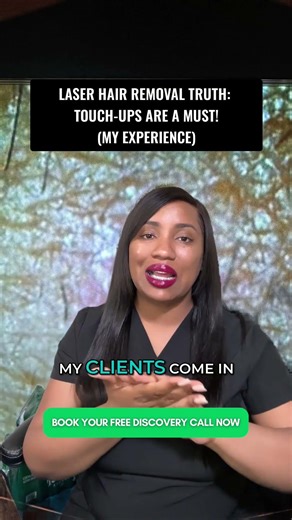 Laser Hair Removal Truth- Touch-Ups Are A MUST! (My Experience)