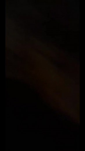 Understanding GERD: The Uncomfortable Reality of Burping Attacks