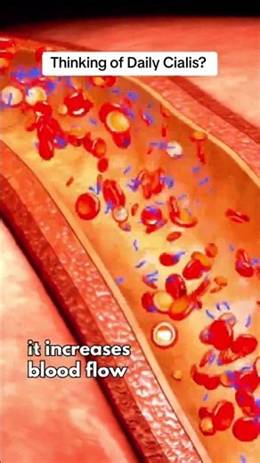 Thinking About Daily Cialis?