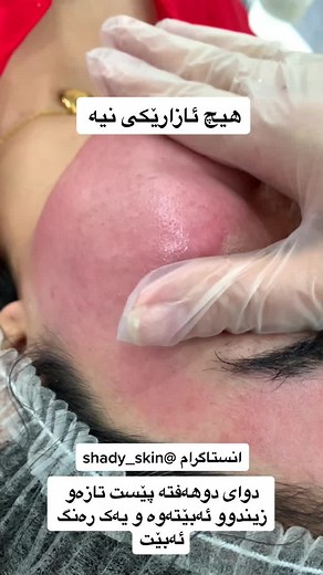 Skincare Treatment Close-Up: Gloved Hand Application