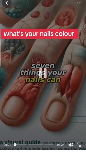 Understanding Nail Discoloration: Causes, Health Issues, and Care