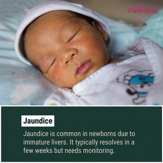 Most Common Health Problems In Newborn Babies That Parents Should Know About