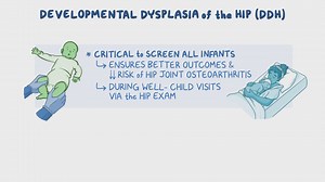 Video: Developmental dysplasia of the hip: Clinical sciences - Video Explanation! | Osmosis | Osmosis