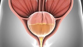 3D Rendering Animation of Human Bladder Filling and Emptying Process Displayed Against a Gray Background. Close Up of Internal Stock Video - Video of motion, bladder: 414970401