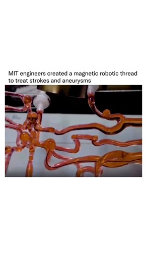 Detailed Explanation on Instagram: "MIT engineers have developed a magnetically steerable, hydrogel-coated robotic thread designed to navigate the brain’s complex vascular network to treat strokes and aneurysms. This device addresses the limitations of traditional manual guidewires, which are often rigid, difficult to steer through winding vessels, and require surgeons to stand near X-ray machines. By using an external magnet and a joystick, doctors can guide the thread remotely, reducing their 