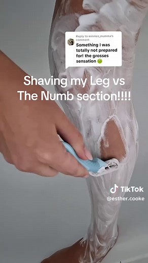 Numbness After Knee Surgery: Shaving the Numb Section Explained