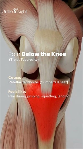 Types of Knee Pain Explained | What Your Knee Pain Is Telling You