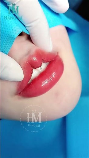 TRANSFORM THICK LIPS INTO KOREAN BABY HEART SHAPED LIPS