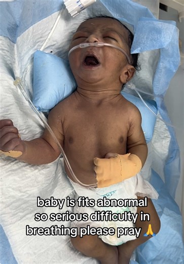 Serious Breathing Difficulty in Baby