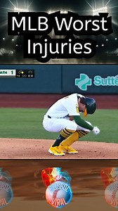 MLB Worst Injuries #baseballlife #mlb #baseball #beisbol | Beisbol Viral