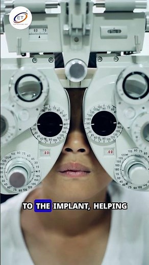 April 15 in science History #BionicEye #MedicalInnovation #VisionRestoration #ENTECH⁣