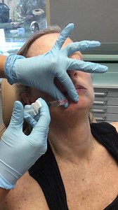 Profhilo Non Surgical Facelift and Skin Remodelling Treatment