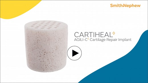 Study shows patients treated with Smith Nephew’s CARTIHEAL™ AGILI-C™ Cartilage Repair Implant have an 87% lower relative risk of Total Knee Arthroplasty or Osteotomy at 4 years¹*