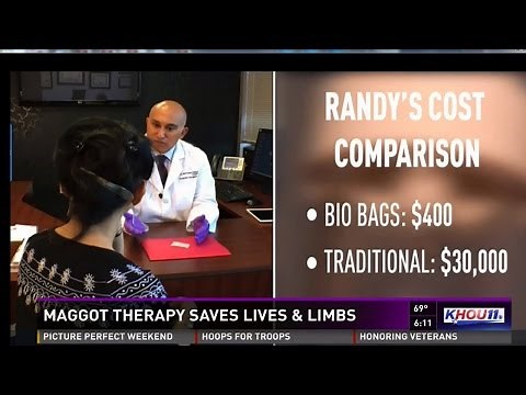 Maggot Therapy for Diabetes | Wound Care Treatment in Sugar Land