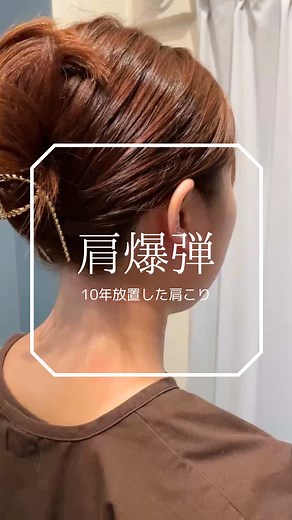 恵比寿の鍼灸院で肩こり解消