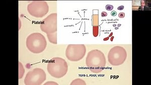 Shoulder Injection Techniques
