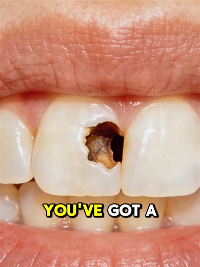 How This Toothpaste Helped My Sensitive Teeth