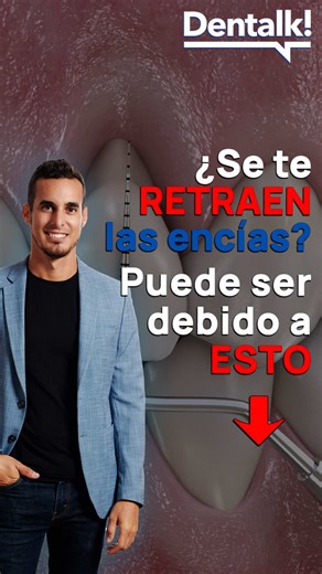 ¿Se te están bajando las encías? Causas y tratamientos de la retracción explicados por un dentista ¿Has notado que tus dientes parecen cada vez más largos? La retracción gingival ocurre cuando la encía se desplaza hacia atrás y deja expuesta la raíz del diente. Y aunque mucha gente piensa que es solo un problema estético, en realidad puede traer consecuencias importantes: • Sensibilidad dental al frío o al cepillado • Mayor riesgo de caries en la raíz • Inflamación o progresión de enfermedad per