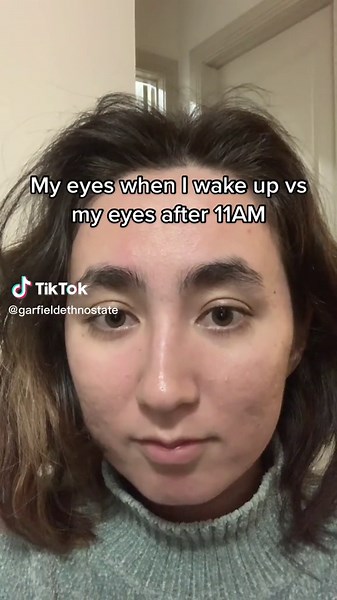 Exploring Triple Eyelids: Makeup Tips and Rarity