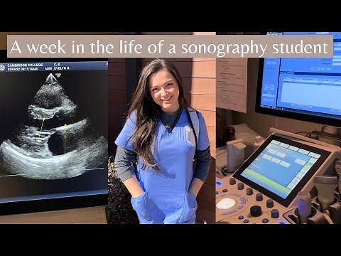 Week in the life of a Sonography Student